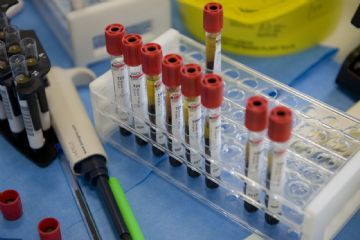 Sospensione ambulatorio prelievi per le festività e calendario 2026